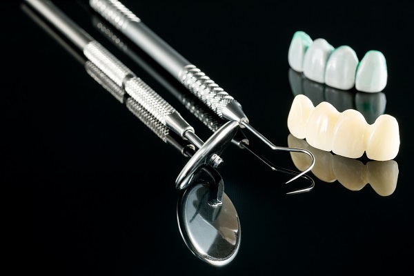 A Guide To   Types Of Dental Bridge